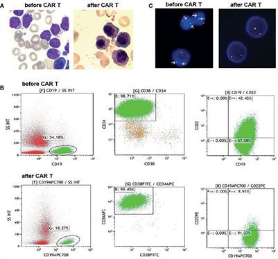 Identification of STRBP as a Novel JAK2 Fusion Partner Gene in a Young Adult With Philadelphia Chromosome-Like B-Lymphoblastic Leukemia